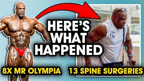 how did ronnie coleman get injured|Ronnie Coleman: Mr. 8x Olympia to 13 Spine Sugeries. Here's .